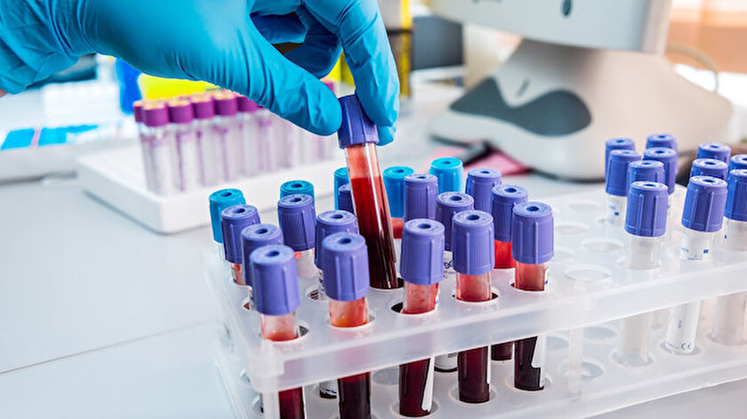 Antikor testlerinin önümüzdeki günlerde daha da yaygınlaşacağı ifade ediliyor.