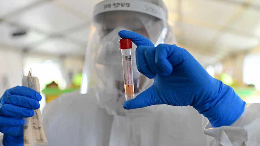 Biobot Analytics araştırma kurumunun çalışması salgın hastalıkların ölçülmesi ve önlenebilmesi açısından önem arzediyor.