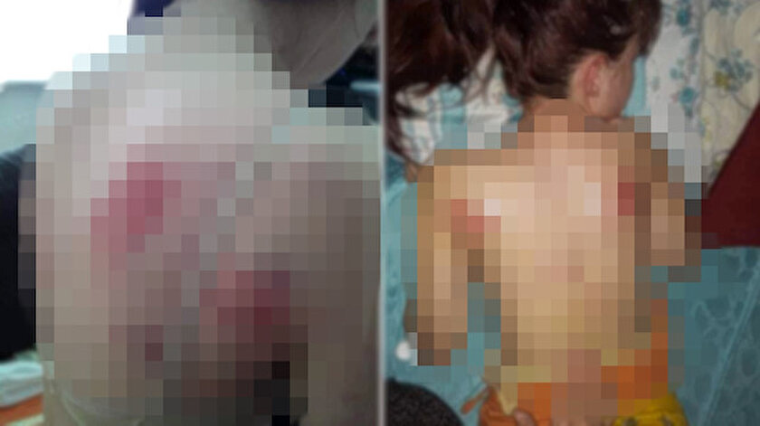 Cani baba, telefon şifresini söylemeyen kızını İngiliz anahtarıyla dövdü.