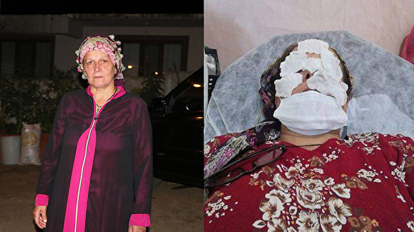 Hatice Çelik, evine geldikten bir süre sonra yüzünde yanma hissetti.