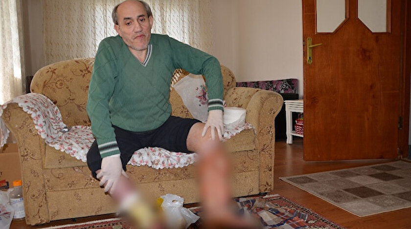 Ayak ülseri hayatını kararttı, evden dışarı çıkamıyor.