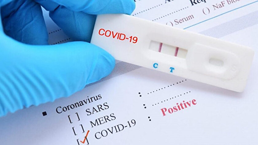 Almanya Koronavirus Test Stratejisi Degistirdi Hafif Semptomlu Hastalara Test Yapilmayacak