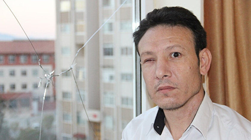 Karamanda inanılmaz olay: Pencereden baktı bir gözünü kaybetti