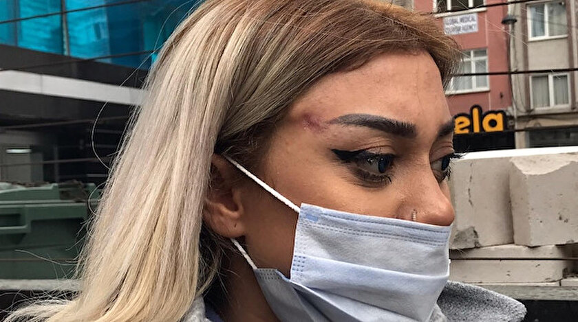 Dünyaca ünlü doktor yalanına kandı yüzündeki hasar iki haftadır geçmiyor
