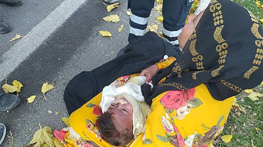 Vücudu yanan çocuğu hastaneye yetiştirmeye çalışırken kaza yaptılar