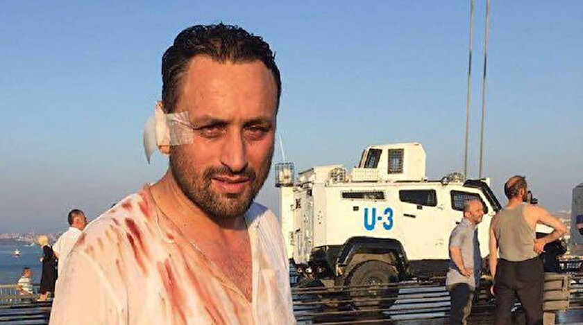 Mustafa Kürşat Yıldırım, 15 Temmuz gecesi cuntacı askerlere direnirken gazi olmuştu.