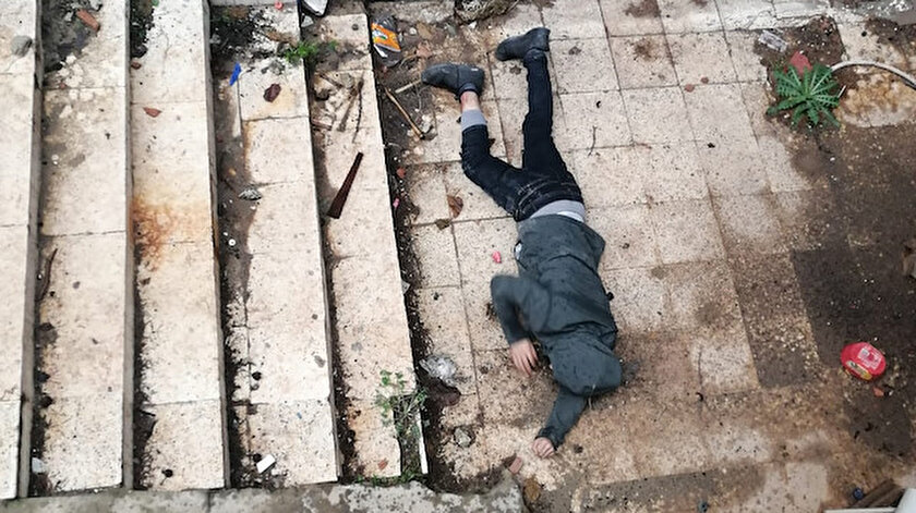 Ayak kemiğinde kırık oluşan S.Ö., hastanede tedaviye alındı.