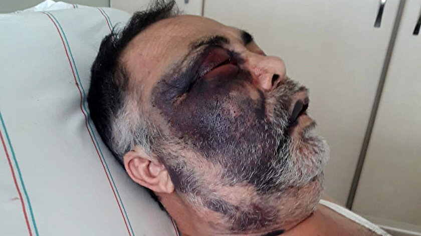 Öldüresiye dövülen Mümin Kara, saldırganların tutuklanmasını istiyor.