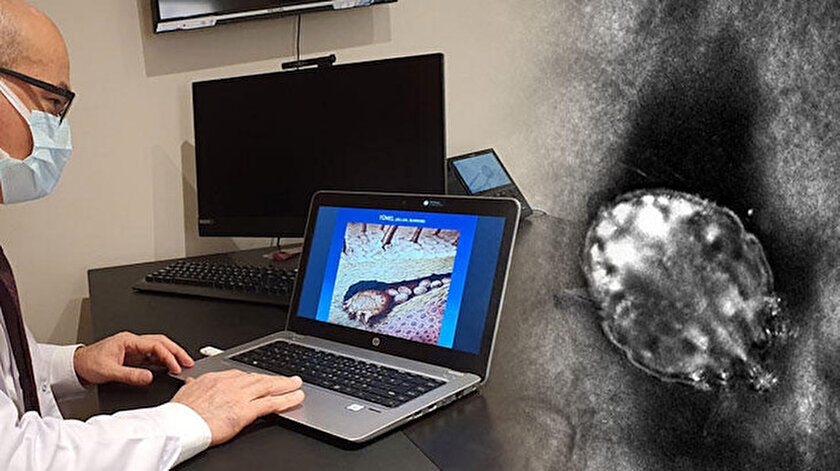 Koronadan sonra uyuz salgını: Hastalar artık ailece doktora gidiyor