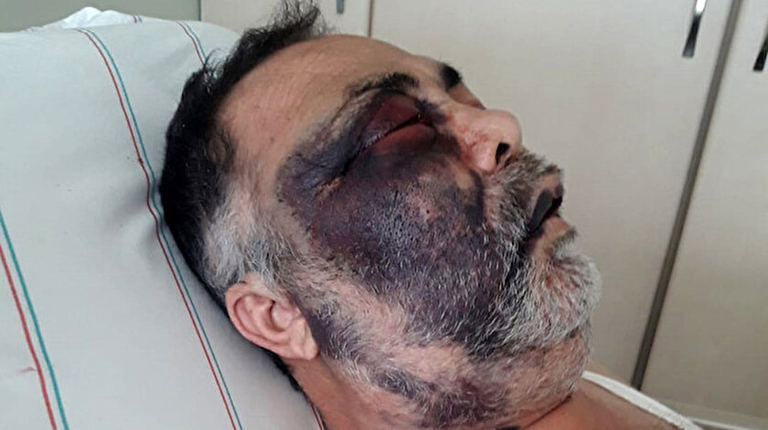 Park meselesi yüzünden darp edilmişti: Yüzde 90 engelli vatandaş hayatını kaybetti