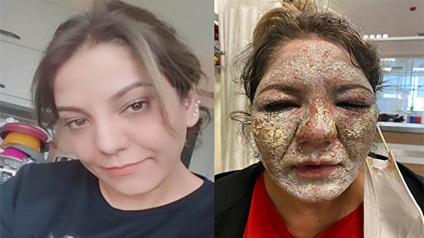 Güzellik merkezinde kabusu yaşadı