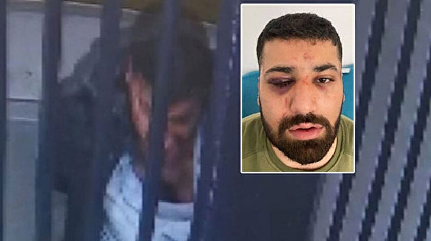 Polis defalarca başıma vurdu dedi: Emniyet görüntülerle yalanladı