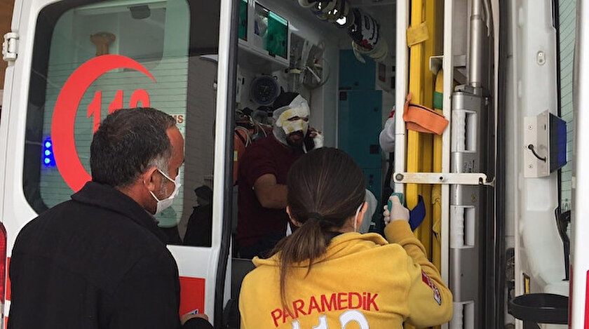 İyilik yapmak istedi alevlerin arasında kaldı: Yüzü yandı