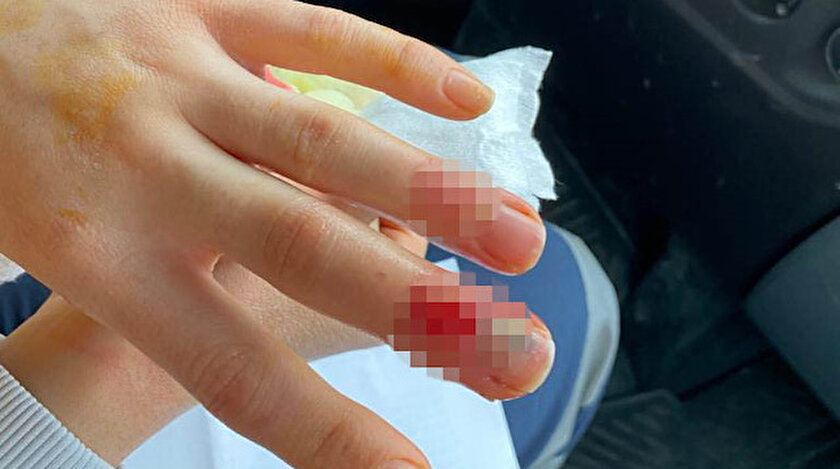 Sağlık görevlisinin çağrı üzerine gittiği evde parmağı ısırıldı: Ucuz atlattım parmağımdan olabilirdim