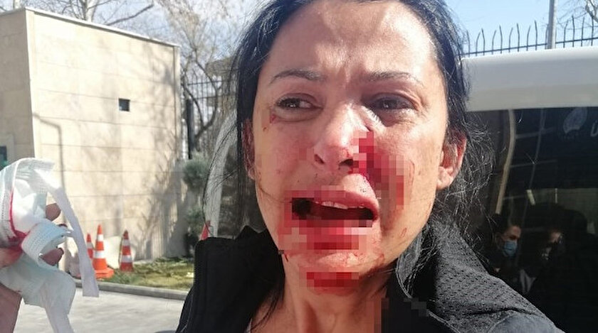 Öğretmen kalemle dehşet saçtı: Aynı sitede oturduğu komşusunu kanlar içinde bıraktı