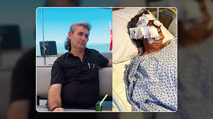 Maymun kafesinden kaçtı otel personelinin yüzünü parçaladı