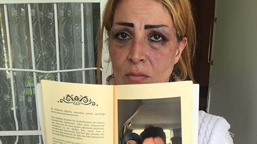 Öldüresiye dövdüğü karısı için aşk kitabı yazmış: Eskiden başımdan aşağı güller döküyordu