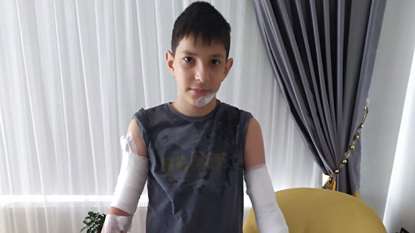 Kırılan cam kapı yüzünden vücudunda kesikler oluşan çocuğa 70 dikiş atıldı