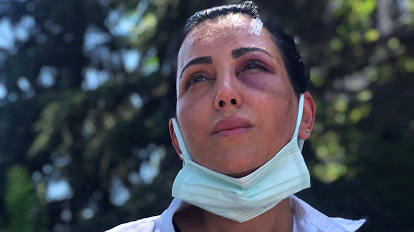 Eski sevgilisinin takside dövdüğü Habibe: 20 dakika boyunca darp etti
