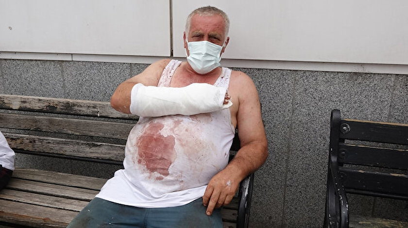 Trabzon Köprübaşı Belediye Başkanı Ali Aydın da kurban keserken yaralandı