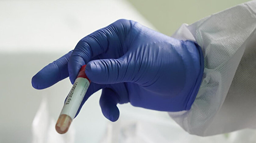 Sağlık ocağında ücretsiz PCR testi yapılıyor mu? - Yeni Şafak