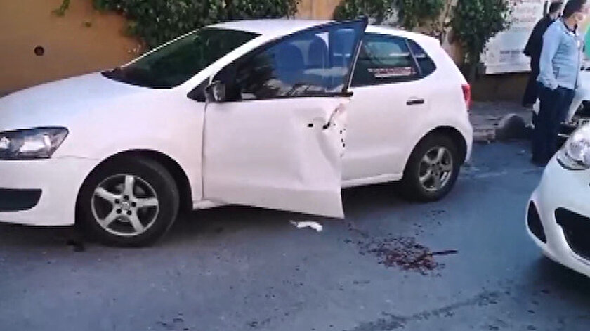 Beyin cerrahının parmakları akıl almaz kazada koptu: Kopan parmaklarıyla hastaneye koştu