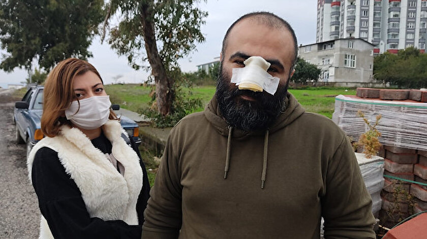 Tasmasız pitbull dehşeti: Bir anda yüzüne atladı burnunu kopardı!