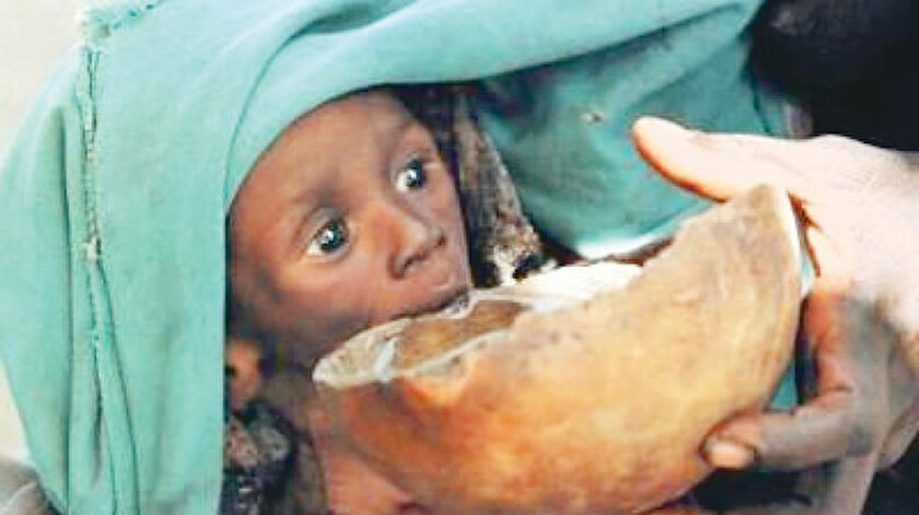 ​Afrikada açlık Avrupada ailesizlik çocukları vuruyor