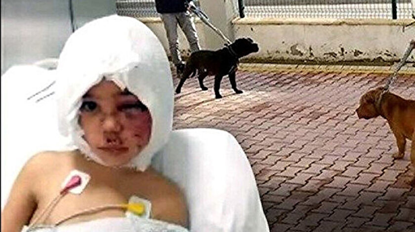 Gaziantepte pitbull saldırısına uğrayan minik Asiyeden güzel haber: Balon tekniğiyle saçlarına kavuşacak