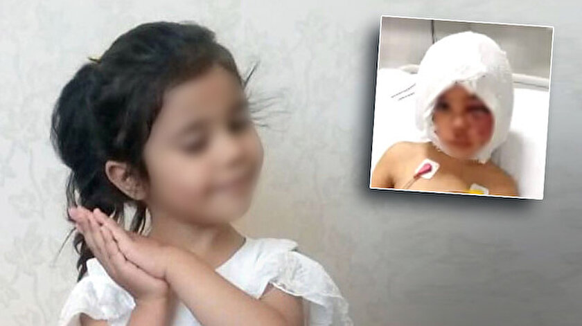 Gaziantepte iki pitbullun saldırdığı çocuğun tedavisine devam ediliyor