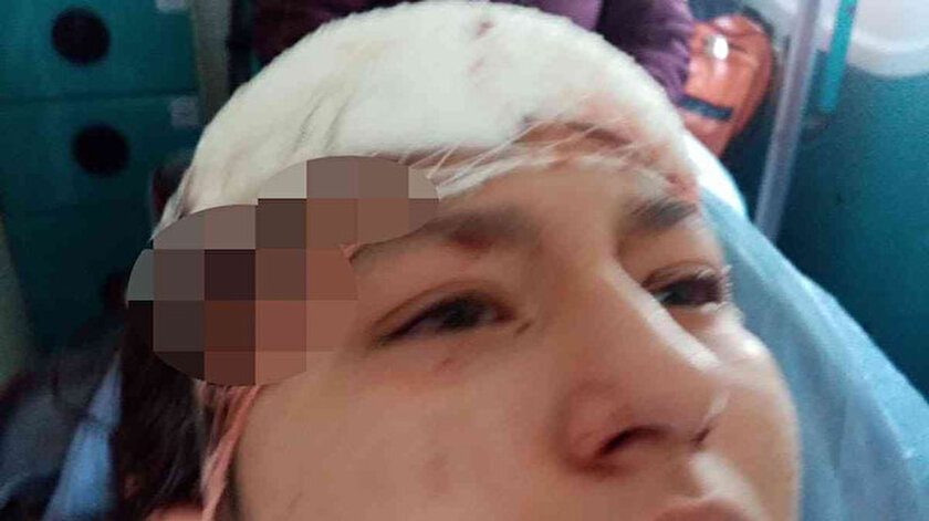 Selfie yaparken köpekler saldırdı: Küçük kız ölümden döndü