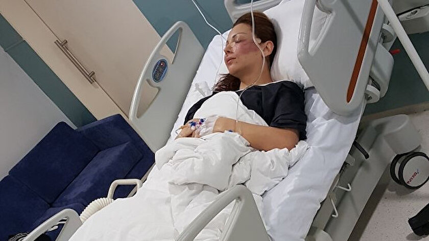 Bulgar modelin estetik kabusu kuaför kardeşler: Örümcek ağı yapmadık, iftira