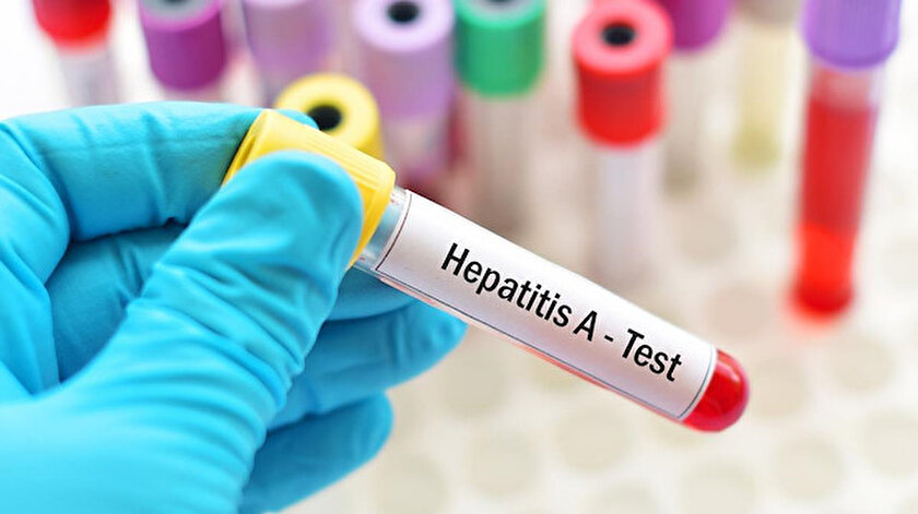 DSÖ: İngilterede görülen hepatit vakalarında artış eğilimi var