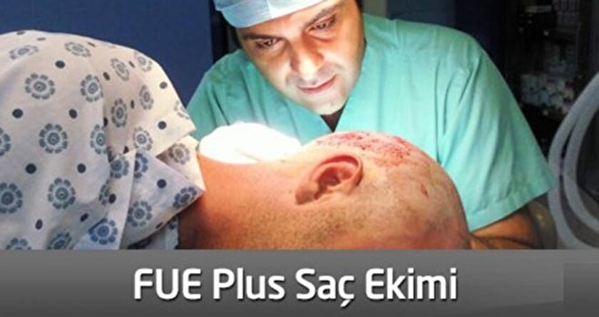 Saç ekimi hakkında merak edilen her şey