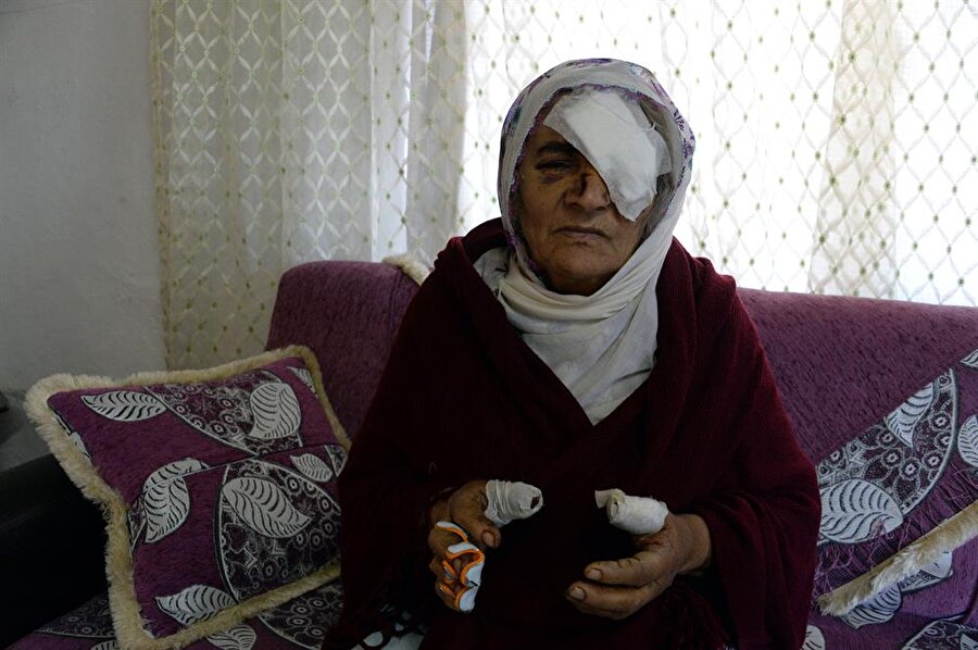 Bahçede bulduğu kutu elinde patladı