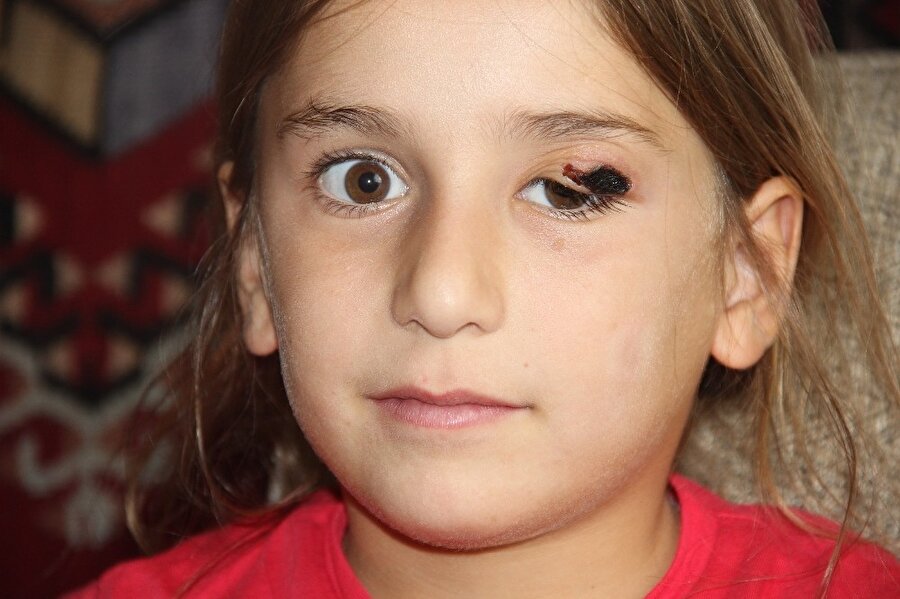 Sivas'ta şarbon paniği