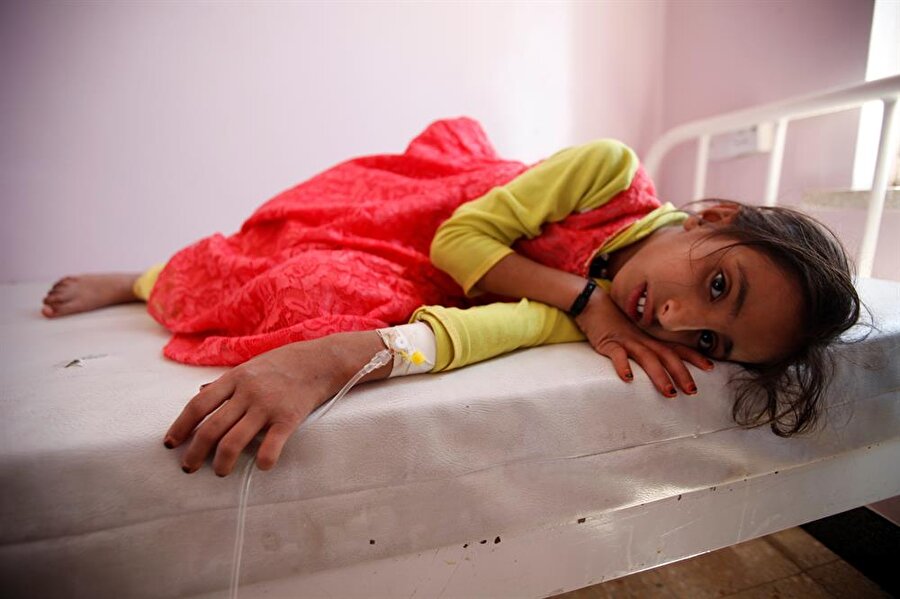 Yemen'de savaş şartlarından dolayı birçok çocuk gıda yetersizliği ve temiz su bulunmaması nedeniyle hayatını kaybediyor.