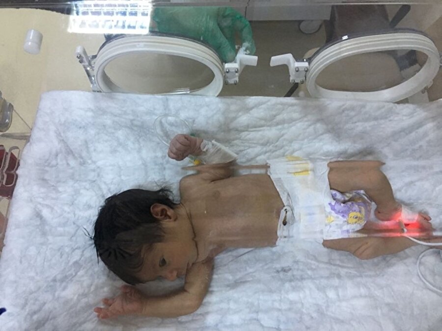 Henüz bir haftalık ve cinsiyetinin kız olduğu belirlenen bebek, hastanenin bebek yoğun bakım ünitesine alındı.