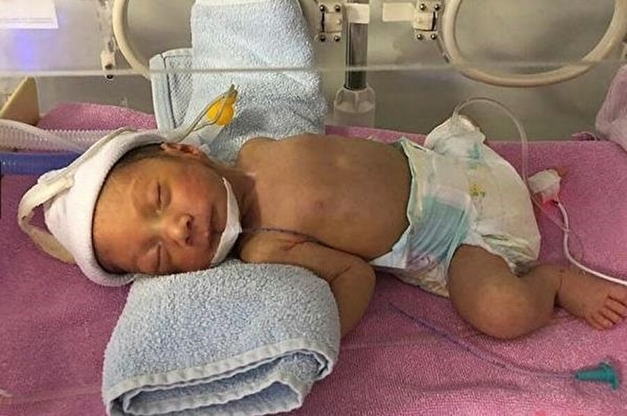 Bebek ilerleyen günlerde ailesine teslim edilecek.