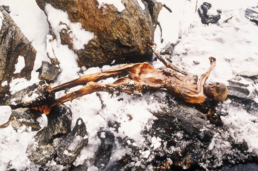 Ötzi