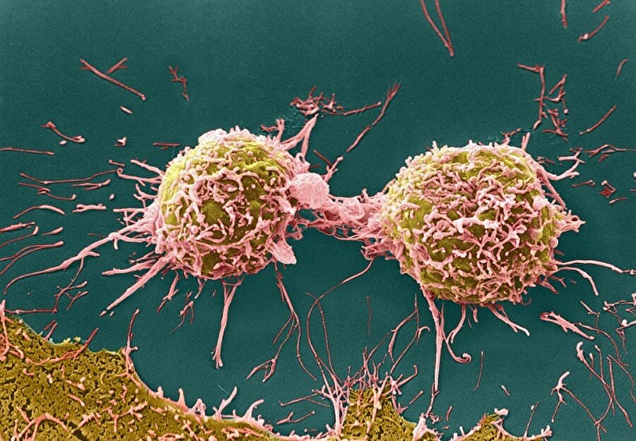 Kanser hücreleri 