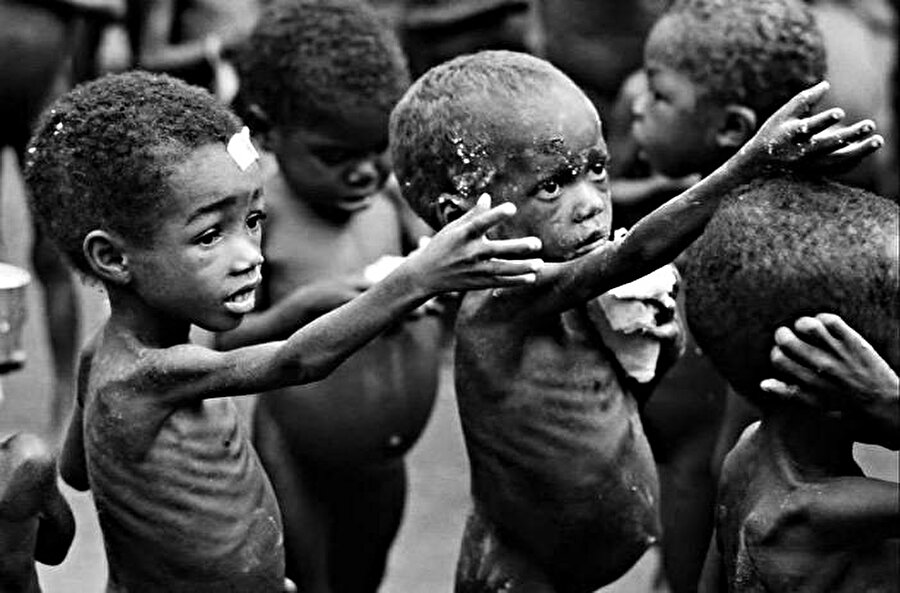 Afrika'da, açlıktan ölen çocukların sayısı her geçen yıl artmaya devam ediyor.