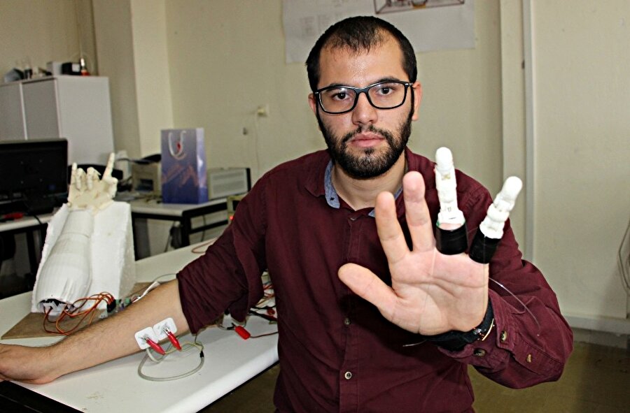 Muhammet Avat, kendi çalışmalarıyla protez parmaklar üretmeyi başardı. 