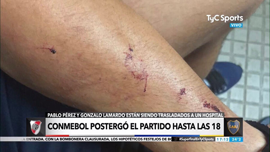 Pablo Pérez vücudunda da yer yer kesikler bulunuyor.