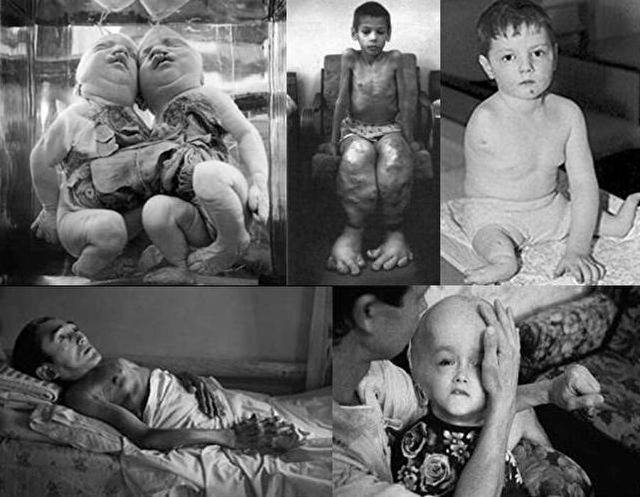 . Bilim adamları, 30.000 ile 60.000 arasında insanın Çernobil’in sebep olduğu kanser türlerinden dolayı öleceğini tahmin ediyor.