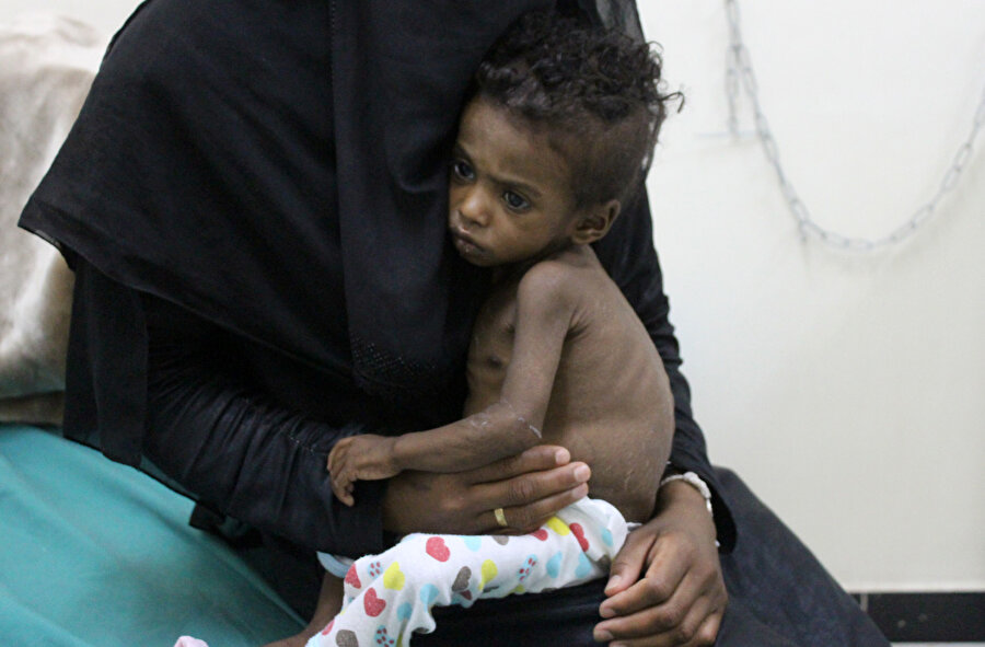 Yemenli bir çocuk annesinin kucağında.