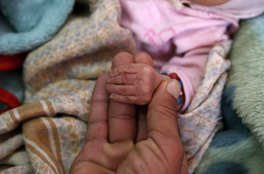 Yemen'de hasta çocuğunun elini tutan bir anne.