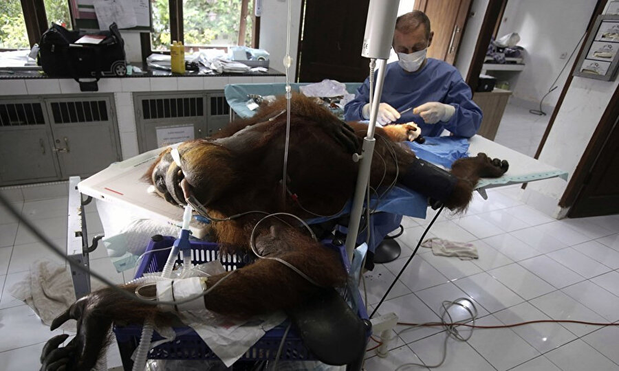 Orangutan ameliyat edildi. 