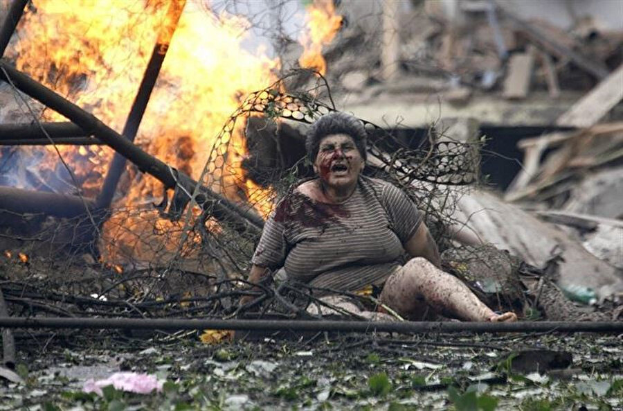 Rus savaş uçaklarının bombaladığı Gürcistan'ın Gori kentinde yaralanan Gürci vatandaşı bir kadın