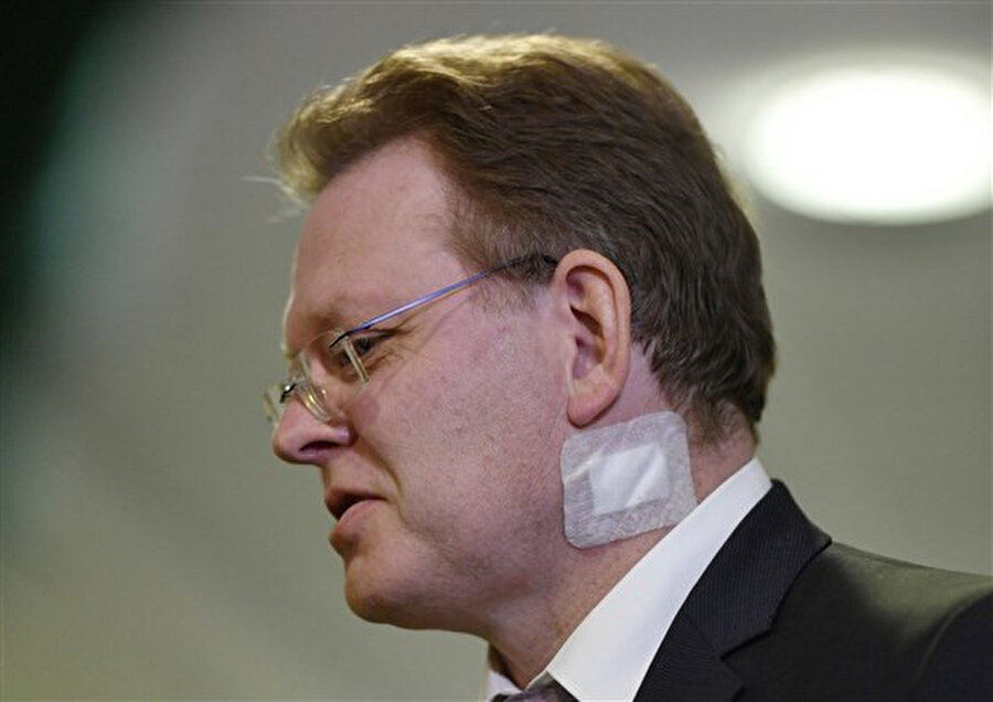  Belediye başkanı Andreas Hollstein, bir kebap restoranında bıçaklanmasından hemen sonra. Altena'daki bir basın toplantısında...